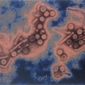 Hepatito c gydymas.jpg